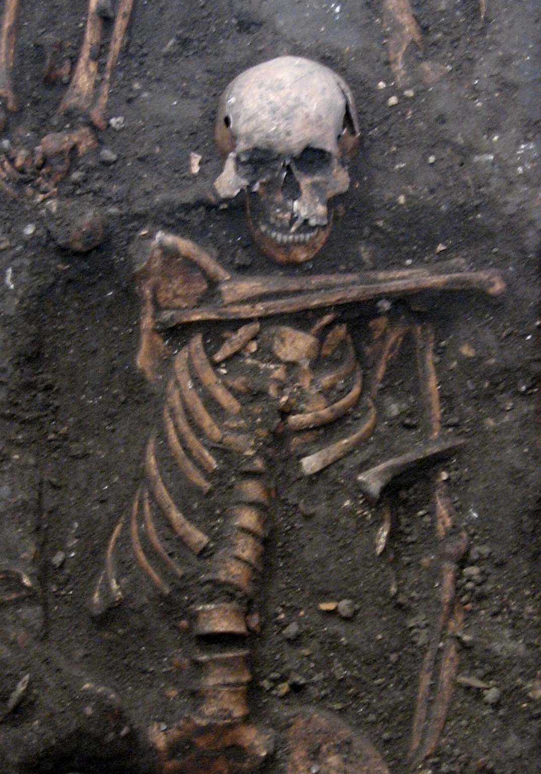 Skeleton